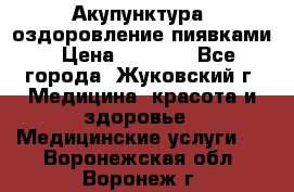 Акупунктура, оздоровление пиявками › Цена ­ 3 000 - Все города, Жуковский г. Медицина, красота и здоровье » Медицинские услуги   . Воронежская обл.,Воронеж г.